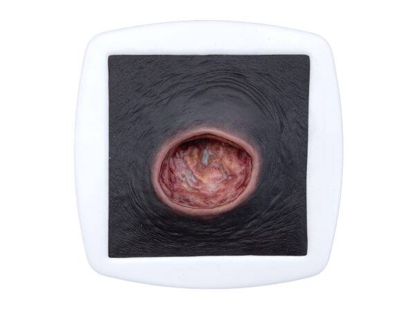 Das „Rahmenmodell Dekubitus mit glattem Wundrand" von MEDICAL FX Germany bietet eine exakte und realistische Darstellung eines Dekubitus mit charakteristisch glatten Wundrändern.…