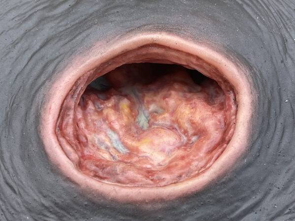 Das „Rahmenmodell Dekubitus mit glattem Wundrand" von MEDICAL FX Germany bietet eine exakte und realistische Darstellung eines Dekubitus mit charakteristisch glatten Wundrändern.…