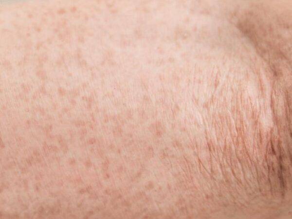 Das „Sockelmodell Arm mit offenliegenden Sehnen" von MEDICAL FX Germany ist eine anatomische Darstellung, die speziell zur Visualisierung der komplexen Sehnenstrukturen des mensch…