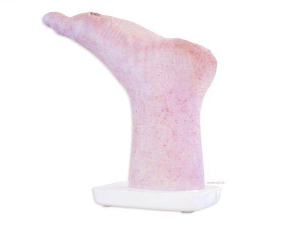 Das „Sockelmodell Zwei-Zehen-Fuß mit 6 Wunden“ von MEDICAL FX Germany präsentiert eine detailreiche Darstellung eines Fußes mit zwei verbliebenen Zehen und sechs verschiedenen Wun…