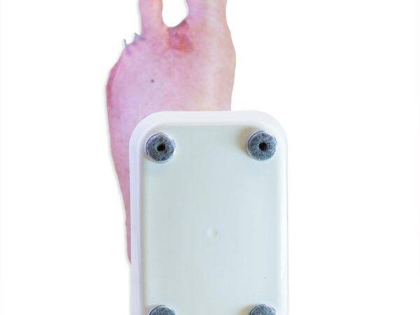 Das „Sockelmodell Zwei-Zehen-Fuß mit 6 Wunden“ von MEDICAL FX Germany präsentiert eine detailreiche Darstellung eines Fußes mit zwei verbliebenen Zehen und sechs verschiedenen Wun…