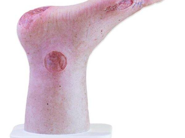 Das „Sockelmodell Zwei-Zehen-Fuß mit 6 Wunden“ von MEDICAL FX Germany präsentiert eine detailreiche Darstellung eines Fußes mit zwei verbliebenen Zehen und sechs verschiedenen Wun…
