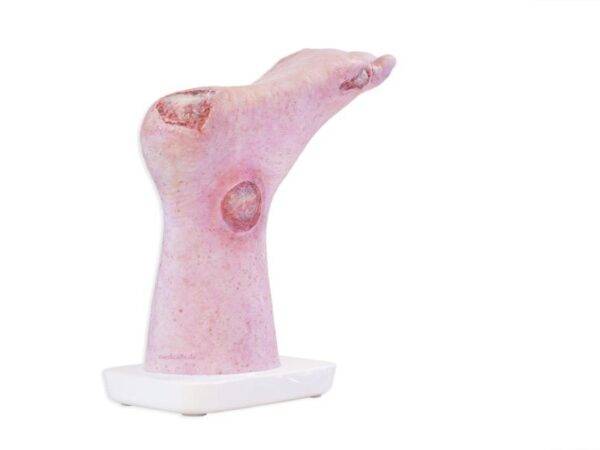 Das „Sockelmodell Zwei-Zehen-Fuß mit 6 Wunden“ von MEDICAL FX Germany präsentiert eine detailreiche Darstellung eines Fußes mit zwei verbliebenen Zehen und sechs verschiedenen Wun…