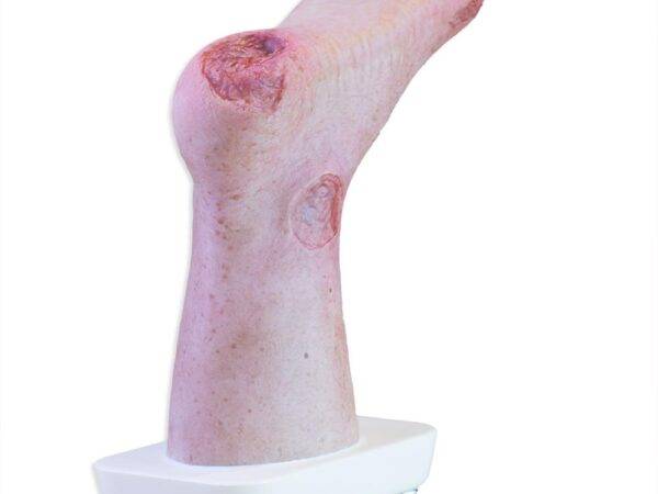 Das „Sockelmodell Zwei-Zehen-Fuß mit 6 Wunden“ von MEDICAL FX Germany präsentiert eine detailreiche Darstellung eines Fußes mit zwei verbliebenen Zehen und sechs verschiedenen Wun…