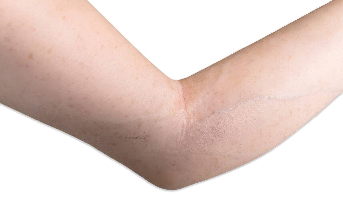 Das „Sockelmodell Arm ohne Wunden“ von MEDICAL FX Germany ist ein hochwertiges anatomisches Lehrmittel, das einen menschlichen Arm in naturgetreuer Nachbildung darstellt. Dieses M…