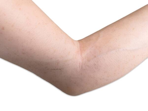 Das „Sockelmodell Arm ohne Wunden“ von MEDICAL FX Germany ist ein hochwertiges anatomisches Lehrmittel, das einen menschlichen Arm in naturgetreuer Nachbildung darstellt. Dieses M…