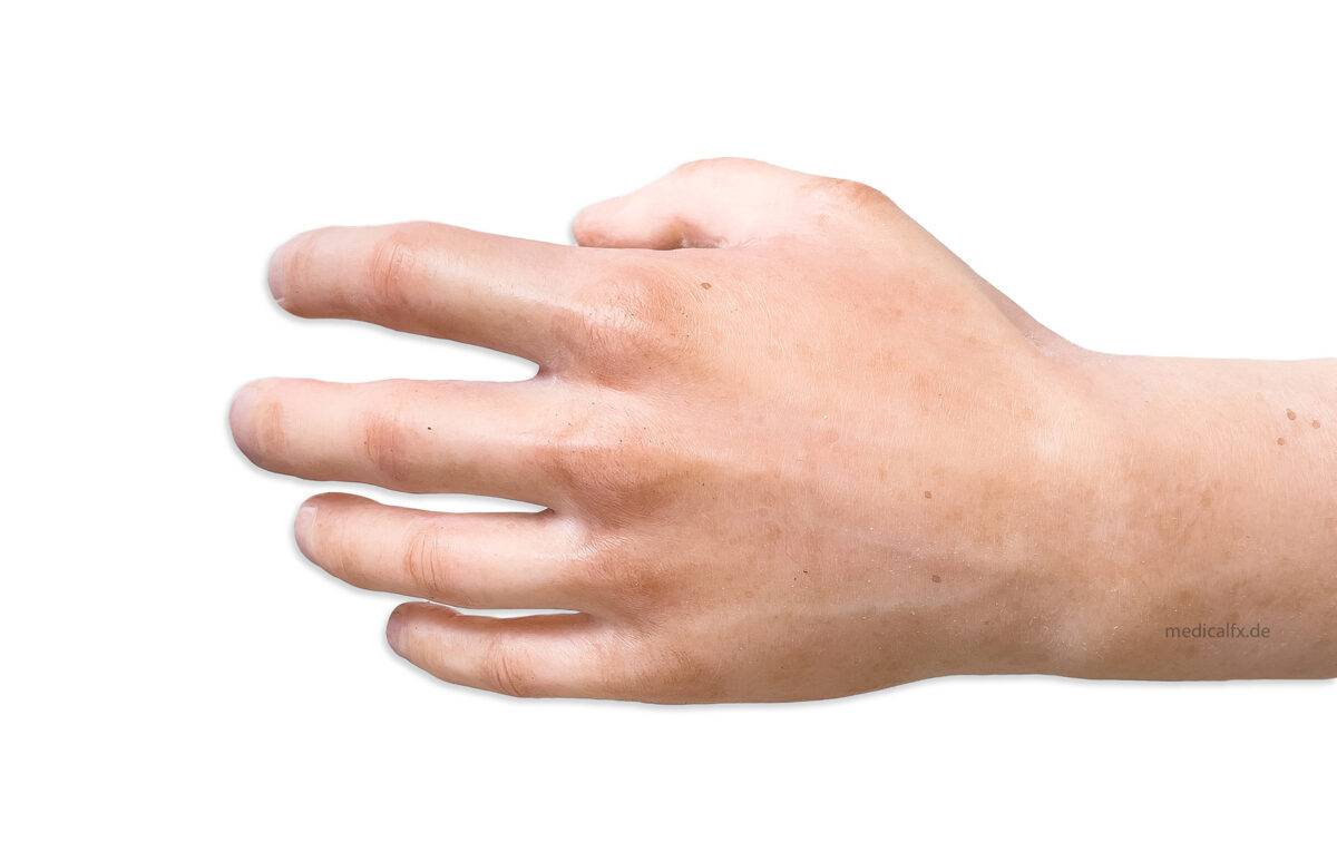 Das „Sockelmodell Arm ohne Wunden“ von MEDICAL FX Germany ist ein hochwertiges anatomisches Lehrmittel, das einen menschlichen Arm in naturgetreuer Nachbildung darstellt. Dieses M…