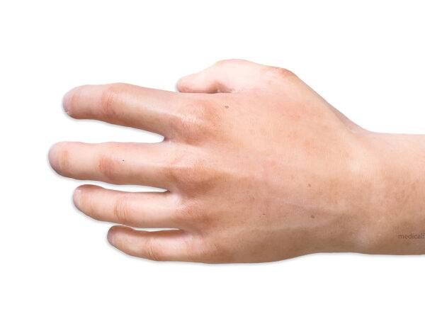 Das „Sockelmodell Arm ohne Wunden“ von MEDICAL FX Germany ist ein hochwertiges anatomisches Lehrmittel, das einen menschlichen Arm in naturgetreuer Nachbildung darstellt. Dieses M…