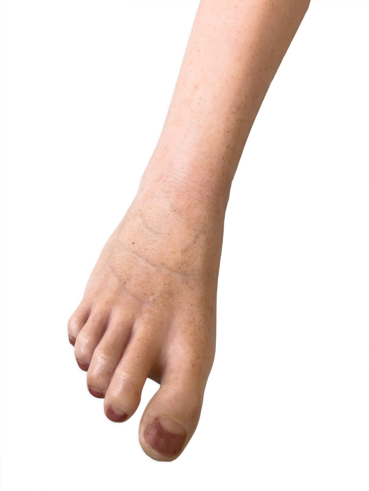 Das „Sockelmodell Bein ohne Wunden" von MEDICAL FX Germany präsentiert sich als eine äußerst realistische Nachbildung eines menschlichen Beins, gefertigt aus hochwertigem Silikon.…