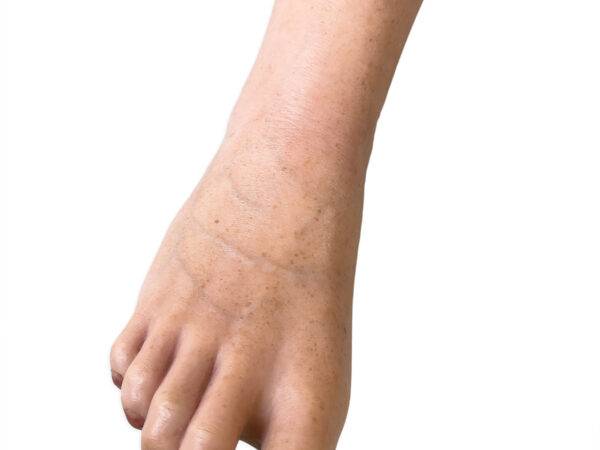 Das „Sockelmodell Bein ohne Wunden" von MEDICAL FX Germany präsentiert sich als eine äußerst realistische Nachbildung eines menschlichen Beins, gefertigt aus hochwertigem Silikon.…