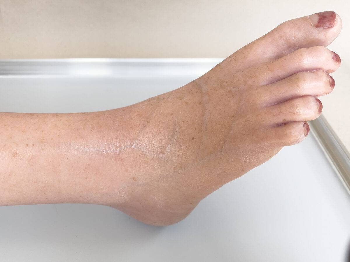 Das „Sockelmodell Bein ohne Wunden" von MEDICAL FX Germany präsentiert sich als eine äußerst realistische Nachbildung eines menschlichen Beins, gefertigt aus hochwertigem Silikon.…