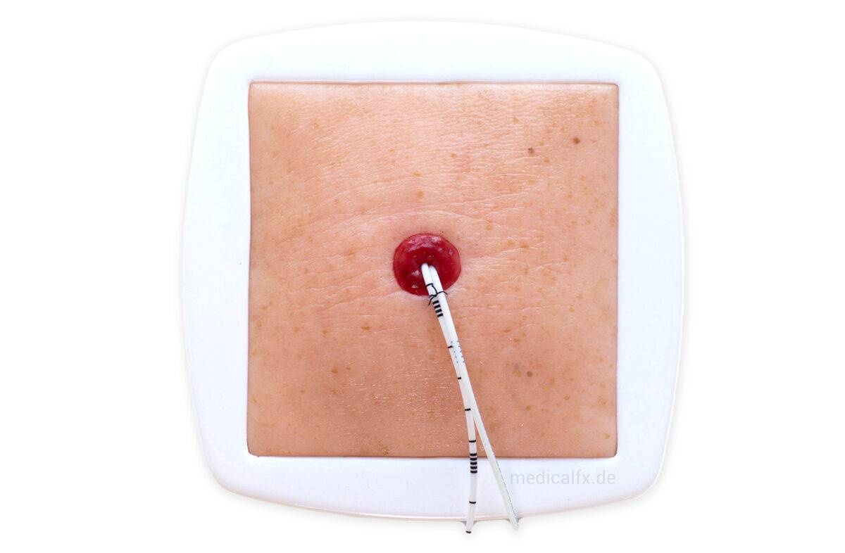 Das „Rahmenmodell Stoma auf Hautniveau“ von MEDICAL FX Germany bietet eine präzise und naturgetreue Darstellung eines Stomas, das exakt auf Hautniveau angelegt ist. Dieses Modell…