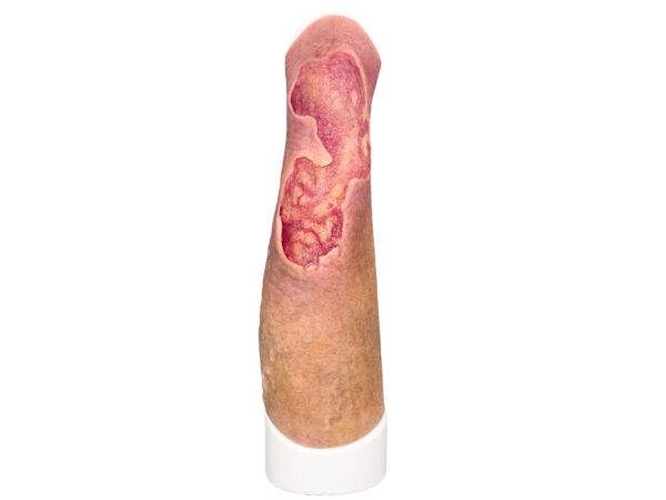 Das Wundmodell „Sleeve Bein mit Gamaschenulkus“ von MEDICAL FX Germany ist ein hochspezialisiertes Trainingswerkzeug, das für das medizinische Training zur Behandlung von venösen…
