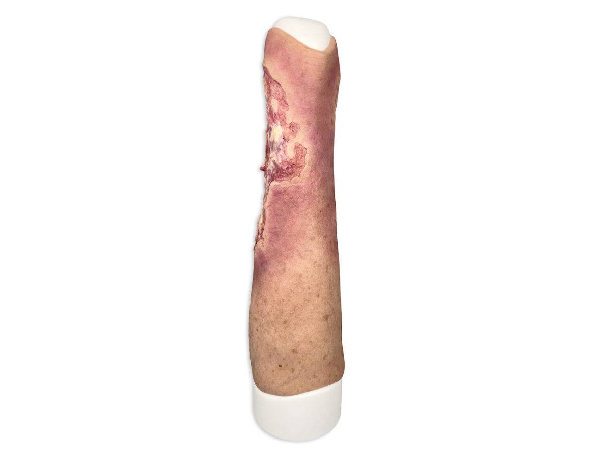 Das Wundmodell „Sleeve Bein mit Gamaschenulkus“ von MEDICAL FX Germany ist ein hochspezialisiertes Trainingswerkzeug, das für das medizinische Training zur Behandlung von venösen…