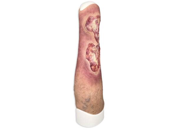 Das Wundmodell „Sleeve Bein mit Gamaschenulkus“ von MEDICAL FX Germany ist ein hochspezialisiertes Trainingswerkzeug, das für das medizinische Training zur Behandlung von venösen…