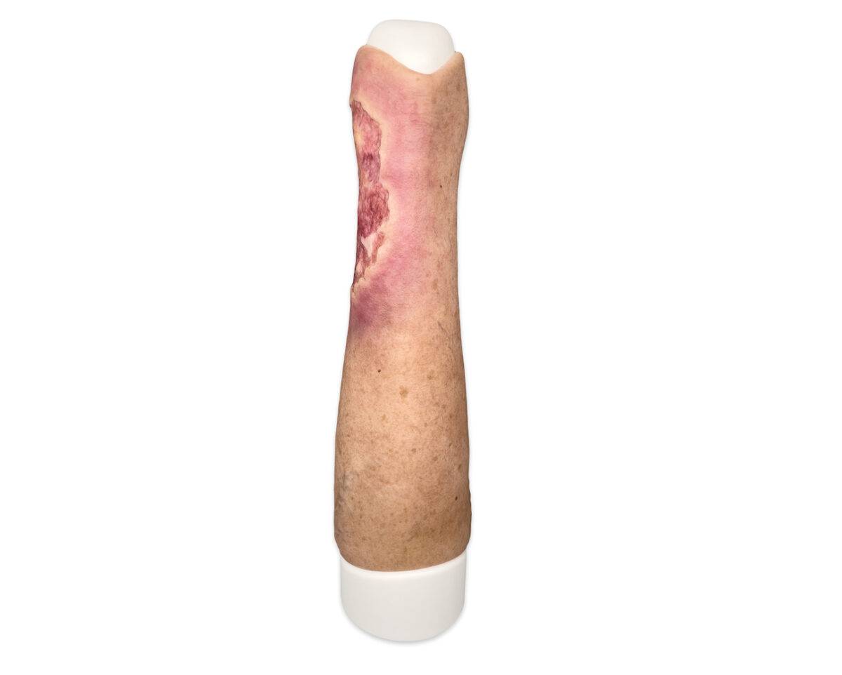 Das Wundmodell „Sleeve Bein mit Ulcus Cruris“ von MEDICAL FX Germany aus hochwertigem Silikon ermöglicht eine blitzschnelle Anwendung auf Trainingsphantomen. Diese praktische Kons…