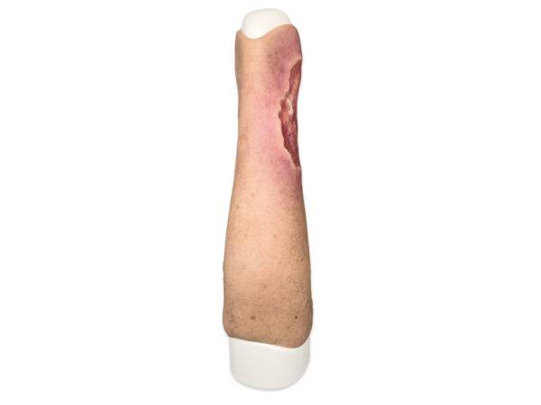 Das Wundmodell „Sleeve Bein mit Ulcus Cruris“ von MEDICAL FX Germany aus hochwertigem Silikon ermöglicht eine blitzschnelle Anwendung auf Trainingsphantomen. Diese praktische Kons…