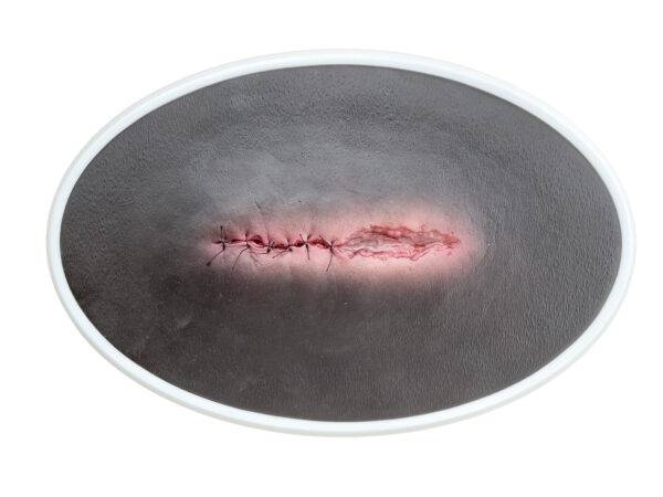 Das „Rahmenmodell OP-Wunde Geöffnet" von MEDICAL FX Germany bietet eine realistische Darstellung einer chirurgischen Wunde in geöffnetem Zustand. Dieses Modell ist in einen robust…