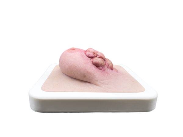 Das „Rahmenmodell Ulcerierendes Mamma-CA (Brusttumor)“ von MEDICAL FX Germany bietet eine detaillierte Darstellung eines ulcerierenden Brusttumors. Es ist in einen robusten, weiße…