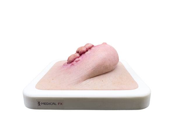 Das „Rahmenmodell Ulcerierendes Mamma-CA (Brusttumor)“ von MEDICAL FX Germany bietet eine detaillierte Darstellung eines ulcerierenden Brusttumors. Es ist in einen robusten, weiße…