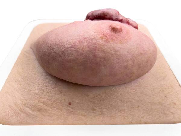 Das „Rahmenmodell Ulcerierendes Mamma-CA (Brusttumor)“ von MEDICAL FX Germany bietet eine detaillierte Darstellung eines ulcerierenden Brusttumors. Es ist in einen robusten, weiße…