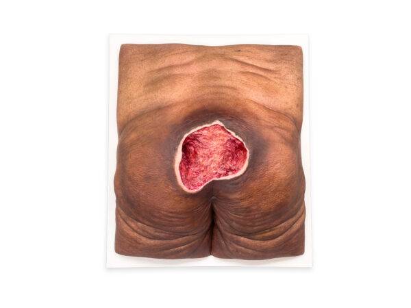 Das „Rahmenmodell Gesäß-Dekubitus" von MEDICAL FX Germany ist eine präzise Nachbildung eines fortgeschrittenen Druckgeschwürs im Sakralbereich, gefertigt aus hochwertigem Silikon.…