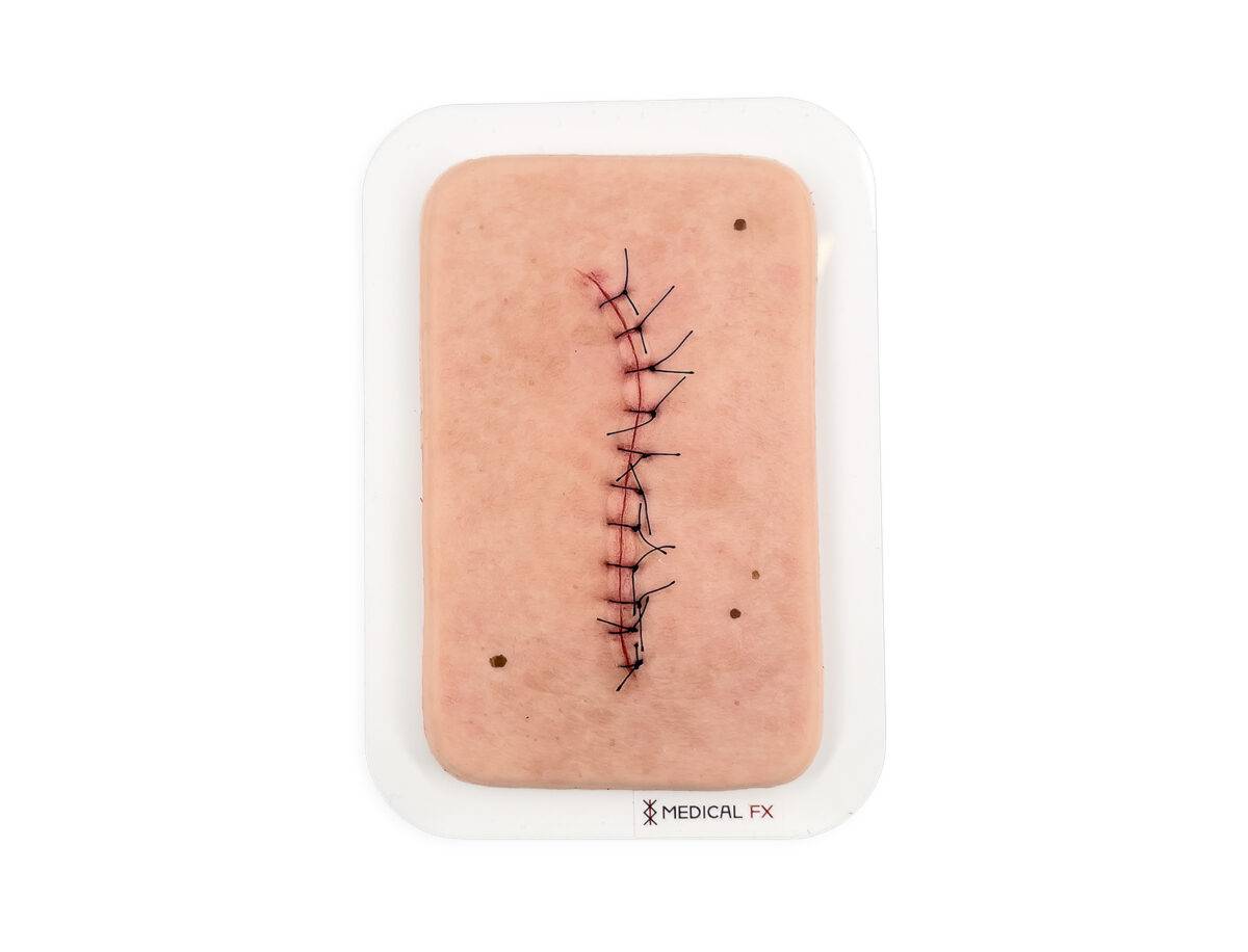 Das Modell „Pocketwunde OP-Wunde Perfekt" von MEDICAL FX Germany simuliert eine postoperative Wunde mit hoher Realitätstreue. Es ist ideal für das Training im Wundmanagement und i…