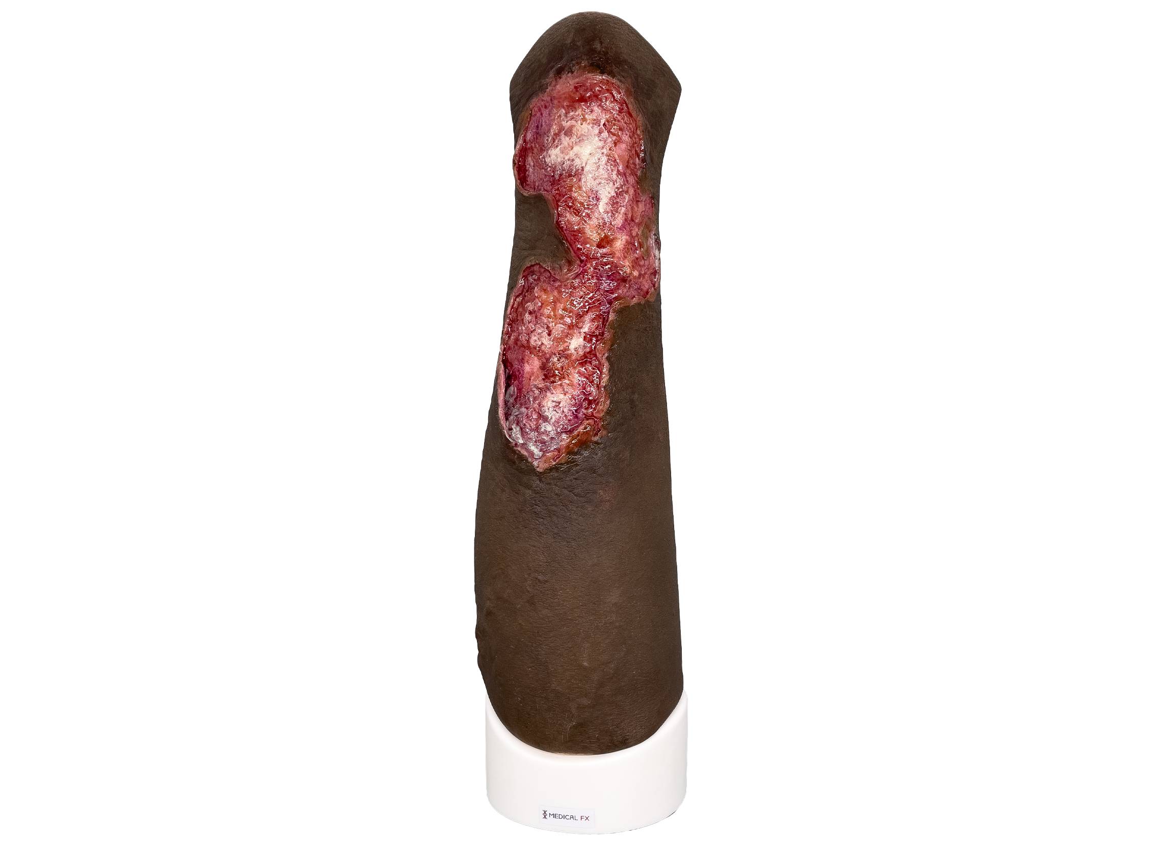 Sleeve Bein mit Gamaschenulkus farbe 4 medicalfx