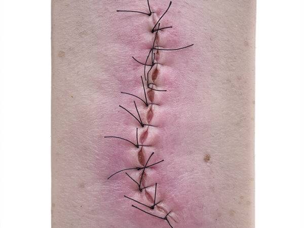 Das Modell „Pocketwunde OP-Wunde Geschlossen und Entzündet“ von MEDICAL FX Germany bietet eine detaillierte Simulation einer postoperativen, entzündeten Wunde. Montiert auf einer…