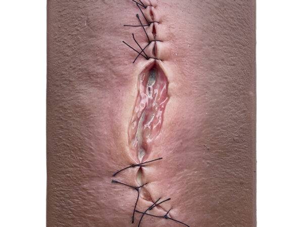 Das Modell „Pocketwunde OP-Wunde Halboffen“ von MEDICAL FX Germany simuliert eine chirurgische Wunde, die teilweise offen ist. Auf einer stabilen Kunststoffplatte montiert und ung…