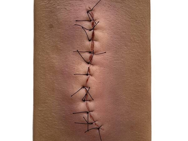 lq 3 pocketwunde op wunde geschwollen Kopie e1685172401509