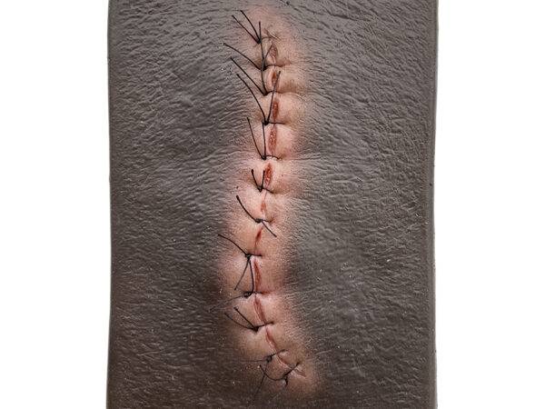 lq 4 pocketwunde op wunde geschwollen Kopie