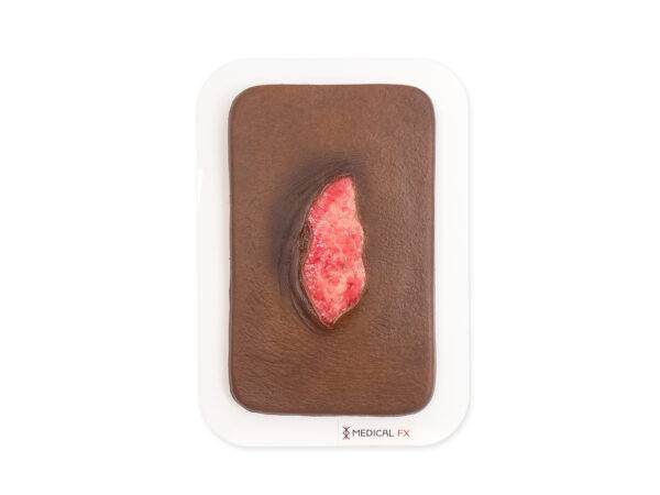 PW10 04 0065 00 4 Pocketwunde Ablederung farbe 4 Skin tears LQ