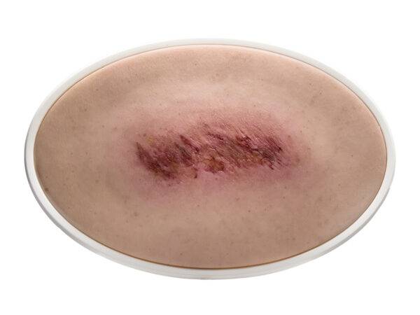 Das „Rahmenmodell Schürfwunde" von MEDICAL FX Germany vereint ästhetische Eleganz mit praktischer Anwendbarkeit und bietet eine detailgetreue Simulation einer Schürfwunde. Umgeben…