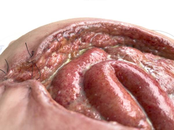 Das „Rahmenmodell Platzbauch" von MEDICAL FX Germany bietet eine realistische Simulation einer postoperativen Nahtdehiszenz, bei der chirurgische Nähte einer frisch verschlossenen…