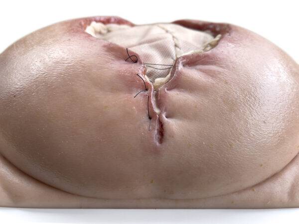 Das „Rahmenmodell Platzbauch" von MEDICAL FX Germany bietet eine realistische Simulation einer postoperativen Nahtdehiszenz, bei der chirurgische Nähte einer frisch verschlossenen…