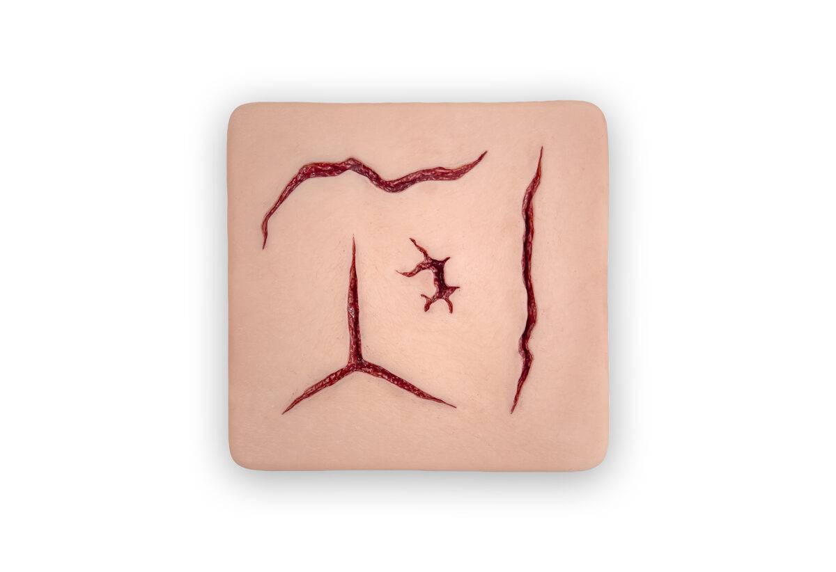 Das Modell „Suture Pad Nahtsimulator" von MEDICAL FX Germany ist ein hochwertiges Übungsmodell aus Silikon, das speziell für das Training chirurgischer Nähtechniken entwickelt wur…