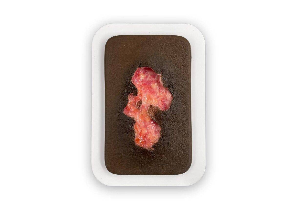 PW10 04 0053 01 4 Pocketwunde Ulcer Chronische Wunde realistisch MEDICALFX Germany best quality Kopie