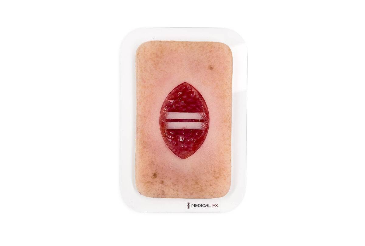 Die „Pocketwunde Chirurgische Wunde mit offenliegenden Sehnen“ von MEDICAL FX Germany im Taschenformat stellt eine chirurgische Wunde mit offenliegenden Sehnen dar und ist auf ein…