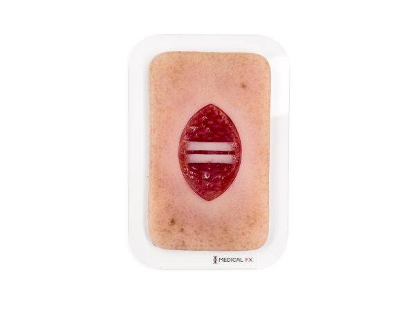 Die „Pocketwunde Chirurgische Wunde mit offenliegenden Sehnen“ von MEDICAL FX Germany im Taschenformat stellt eine chirurgische Wunde mit offenliegenden Sehnen dar und ist auf ein…