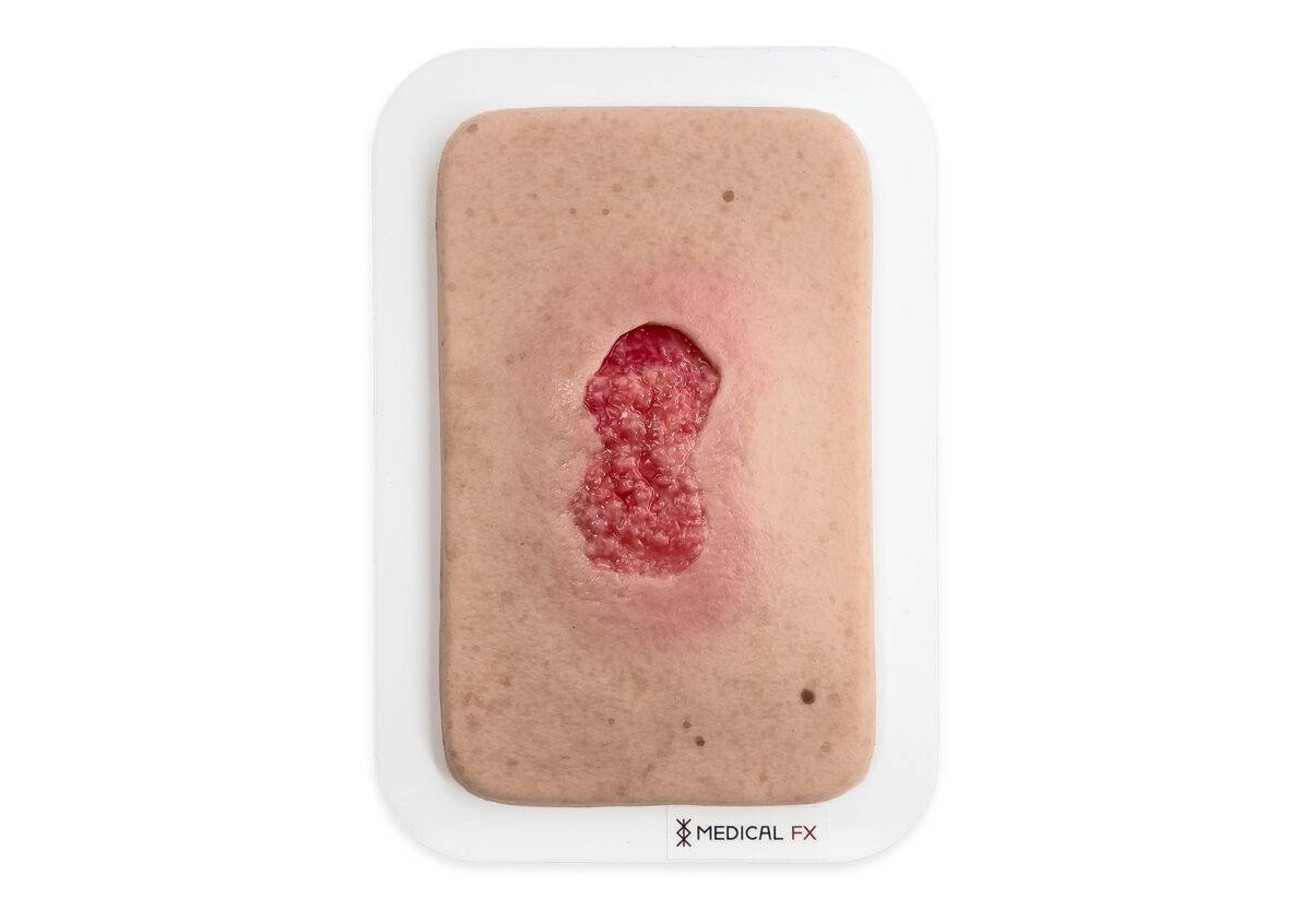 Das „Pocketwunde Granulation"-Wundmodell von MEDICAL FX Germany kommt im praktischen Smartphone-Format und vereint dadurch detaillierte anatomische Genauigkeit mit außerordentlich…