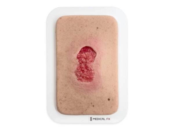 Das „Pocketwunde Granulation"-Wundmodell von MEDICAL FX Germany kommt im praktischen Smartphone-Format und vereint dadurch detaillierte anatomische Genauigkeit mit außerordentlich…
