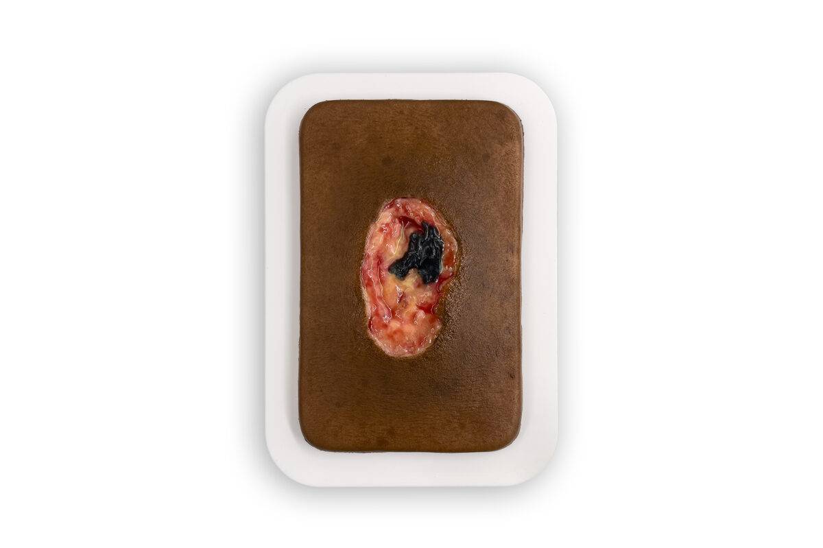 PW10 04 0064 00 3 Pocketwunde Nekrose Farbe 3 MEDICALFX GERMANY realistisch Kopie