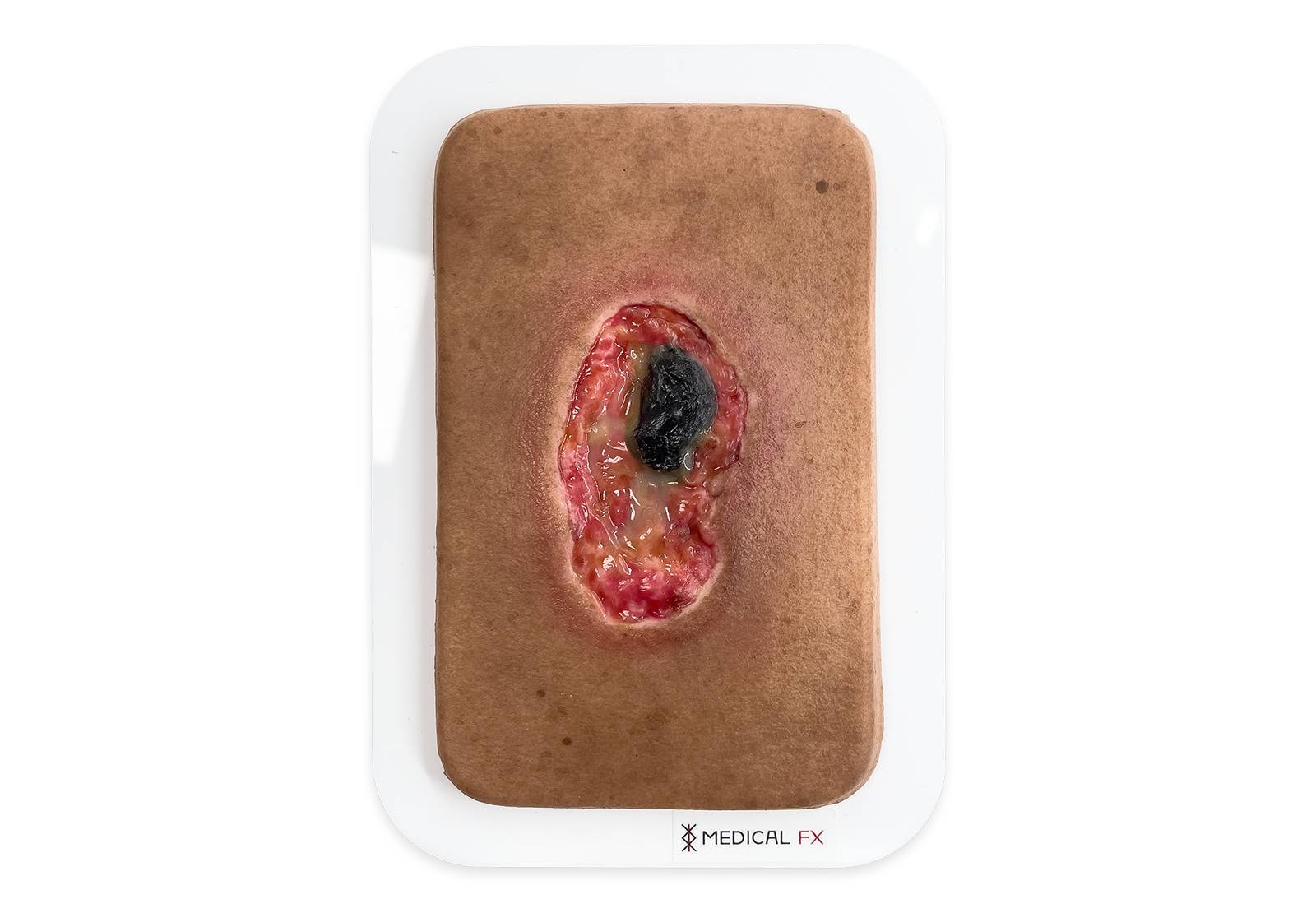 PW10 04 0064 00 3Pocketwunde Nekrose Farbe 3 LQ