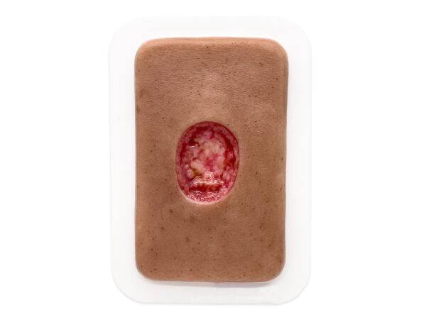 Pocketwunde Chirurgische Wunde MOHS medicalfx silikonmodell silikonwunde