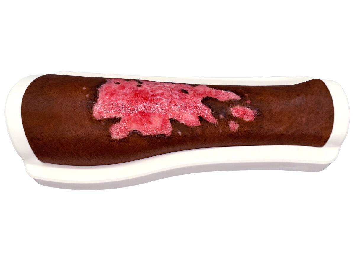 Das „Rahmenmodell Bein mit Brandwunde Grad 3" von MEDICAL FX Germany bietet eine präzise und detaillierte Darstellung einer schweren Brandverletzung am Bein. Dieses Modell ist aus…