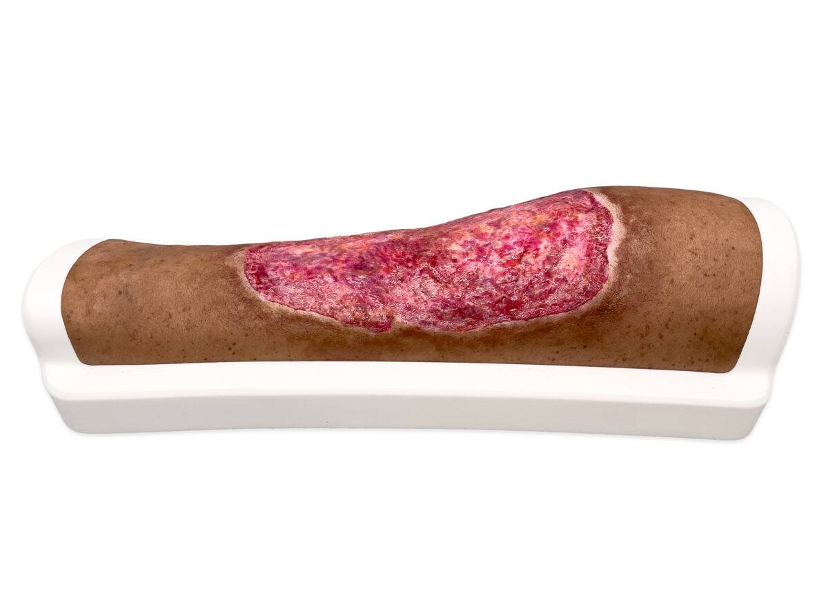 Das „Rahmenmodell Venous Leg Ulcer (VLU)“ von MEDICAL FX Germany stellt ein venöses Beingeschwür dar und ist ein spezialisiertes Lehrmittel, das zur detaillierten Darstellung und…