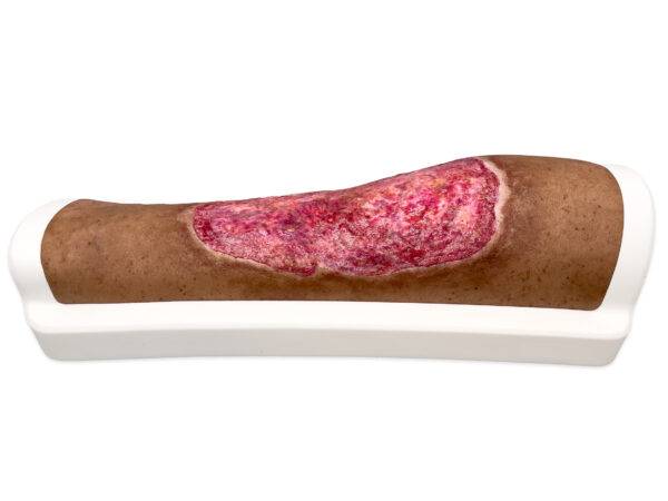 Das „Rahmenmodell Venous Leg Ulcer (VLU)“ von MEDICAL FX Germany stellt ein venöses Beingeschwür dar und ist ein spezialisiertes Lehrmittel, das zur detaillierten Darstellung und…