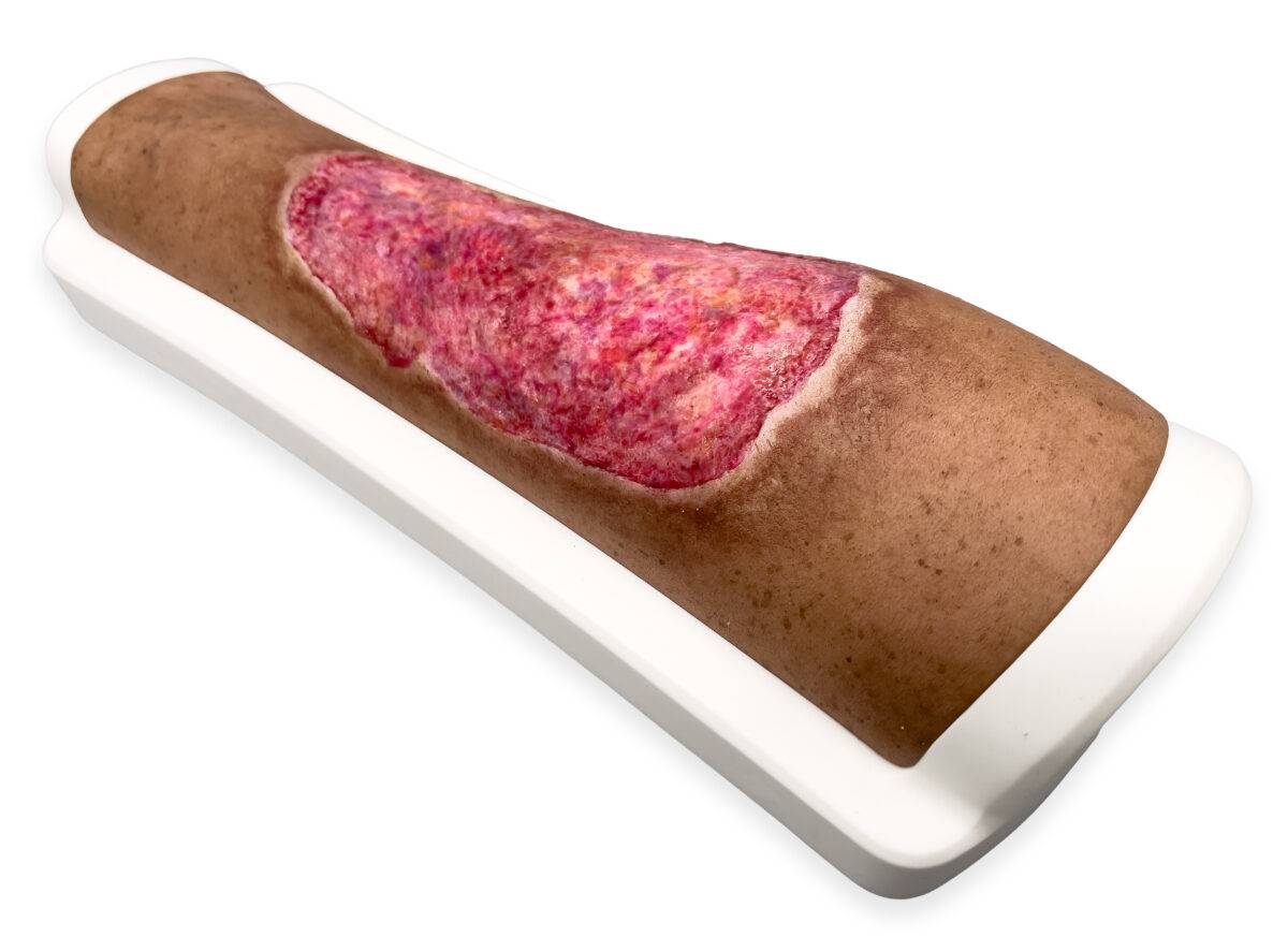 Das „Rahmenmodell Venous Leg Ulcer (VLU)“ von MEDICAL FX Germany stellt ein venöses Beingeschwür dar und ist ein spezialisiertes Lehrmittel, das zur detaillierten Darstellung und…