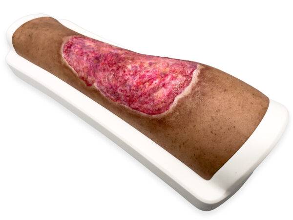 Das „Rahmenmodell Venous Leg Ulcer (VLU)“ von MEDICAL FX Germany stellt ein venöses Beingeschwür dar und ist ein spezialisiertes Lehrmittel, das zur detaillierten Darstellung und…